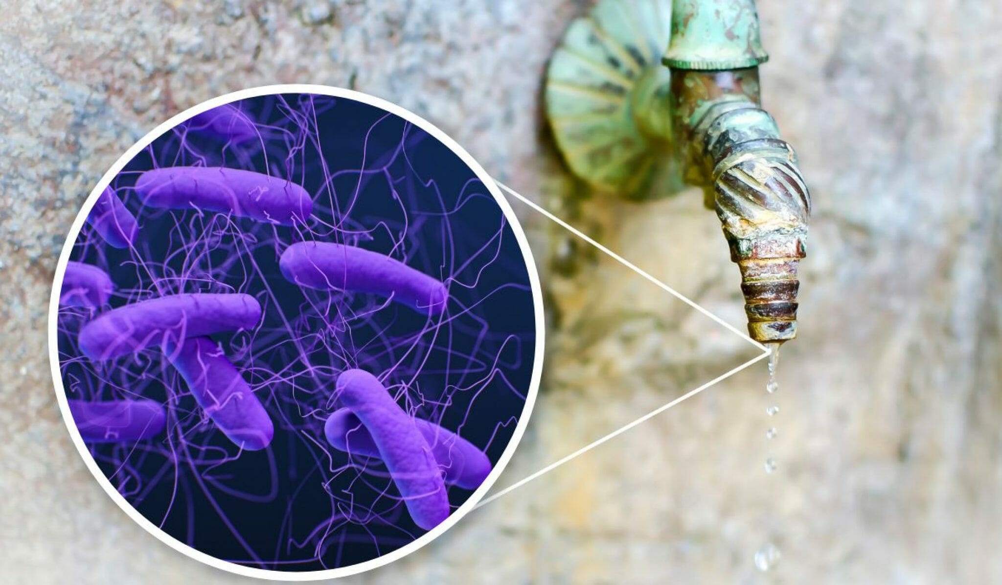 E Coli In Water (Everything You Need To Know) Freshnss