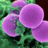 Does Reverse Osmosis Remove Fluoride: The Truth!